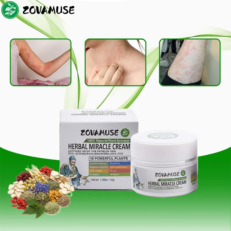 Hives Relief Cream for Itchy, Raised Skin