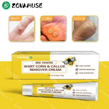 Bee Venom Corn & Callus Remover Cream - ZOVAMUSE