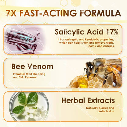Bee Venom Corn & Callus Remover Cream - ZOVAMUSE