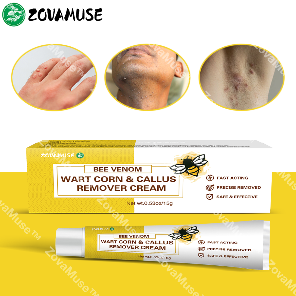 Bee Venom Wart Remover Cream