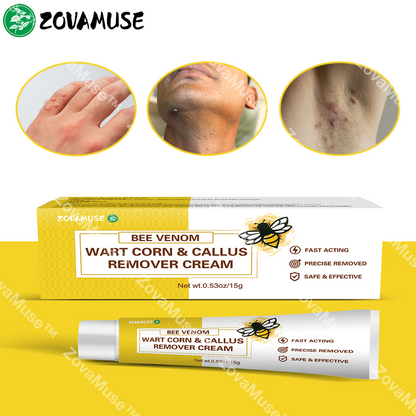Bee Venom Wart Remover Cream