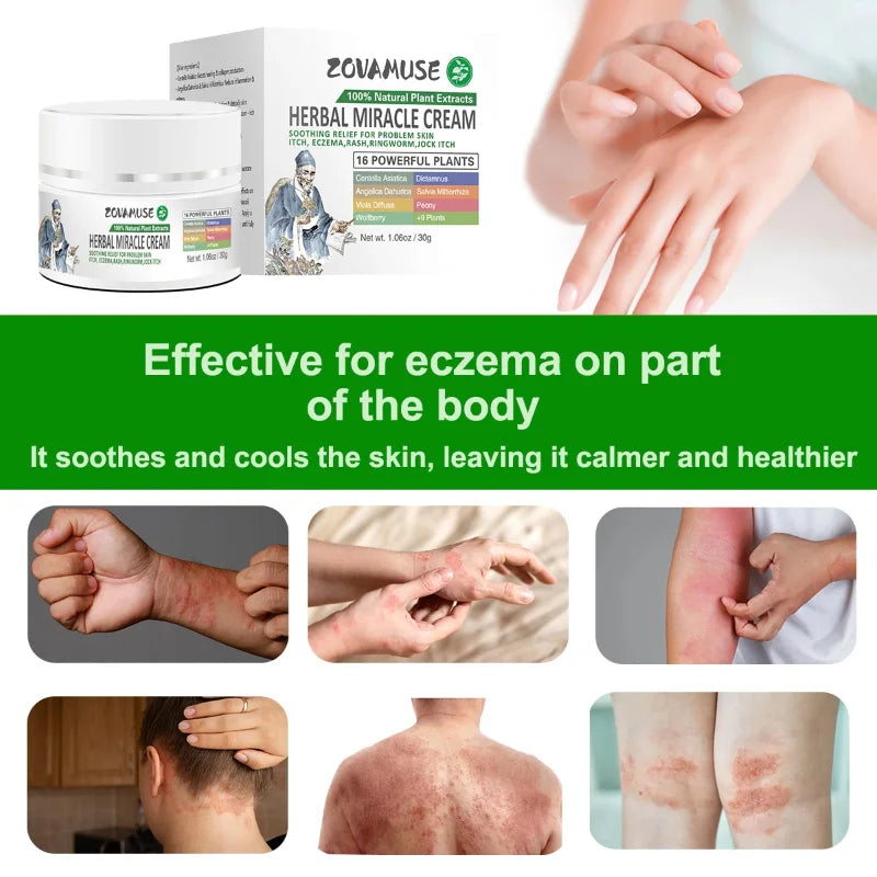 Eczema Relief Cream for Dry, Itchy Skin