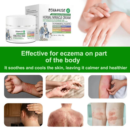 Eczema Relief Cream for Dry, Itchy Skin