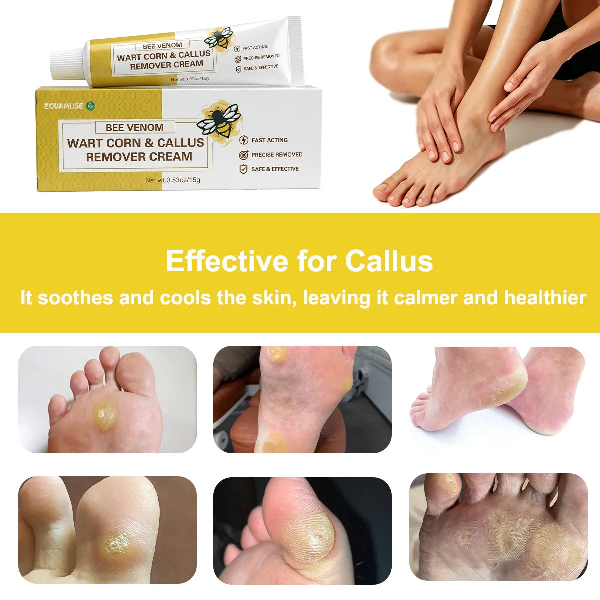 Callus Softening Cream for Dry, Cracked Skin