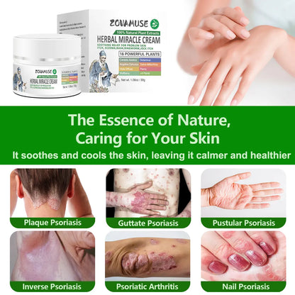 Psoriasis Relief Cream for Itchy, Flaky Skin