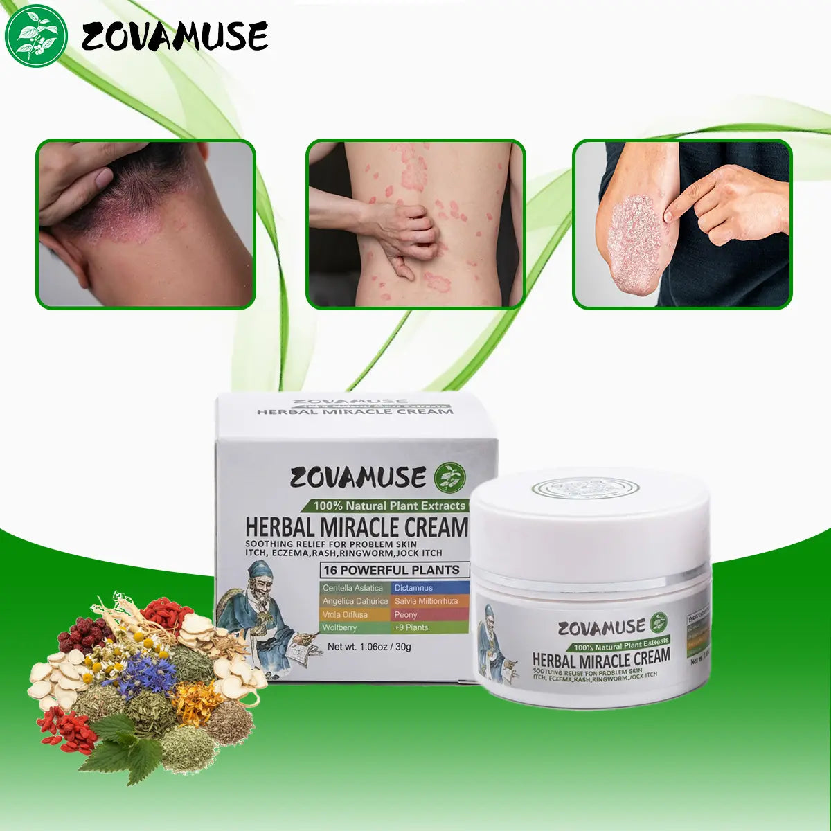 Psoriasis Relief Cream for Itchy, Flaky Skin